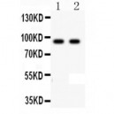 Li Cadherin Antibody Novatein Biosciences