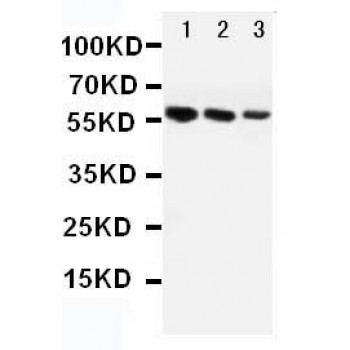 Angiotensinogen Antibody Novatein Biosciences