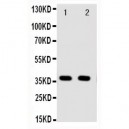 Annexin A10 Antibody