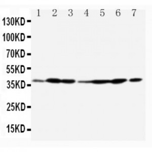 Annexin A2 Antibody