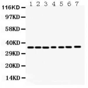 Annexin A3  Antibody