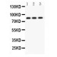 Apolipoprotein J  Antibody