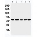 Apolipoprotein J Antibody