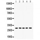 Aquaporin 1  Antibody