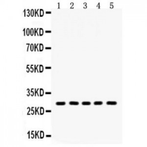 Aquaporin 1  Antibody