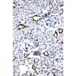 Aquaporin 2 Antibody