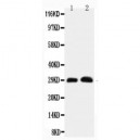 Aquaporin 5 Antibody