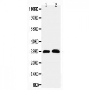 Aquaporin 5 Antibody