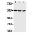 Aromatase Antibody