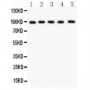 ASPH  Antibody