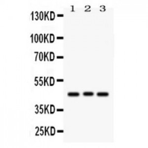 Ataxin 3  Antibody