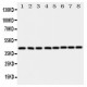 Ataxin 3 Antibody