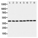 Ataxin 3 Antibody