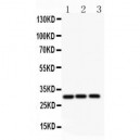 ATF1  Antibody