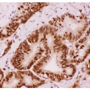 ATF2  Antibody