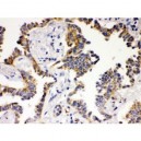 ATG14L  Antibody