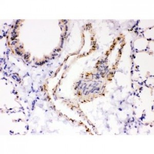 ATP2A2 Antibody