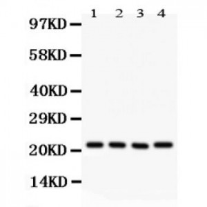 ATP5H  Antibody