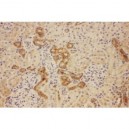 ATP7b Antibody