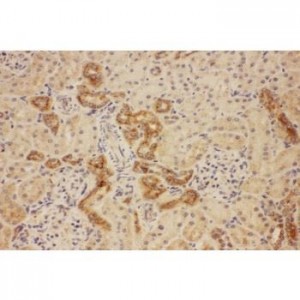 ATP7b Antibody