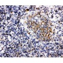 BAFF Antibody