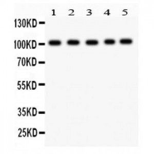 Band 3  Antibody