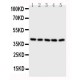 BCAT2 Antibody