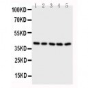 BCAT2 Antibody