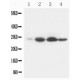 Bcl-2 Antibody (monoclonal)