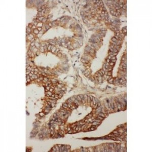 BCL2L2 Antibody