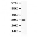 beta Amyloid  Antibody