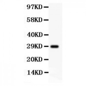 beta Amyloid  Antibody