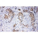 beta Arrestin 1 Antibody