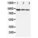 beta Catenin Antibody