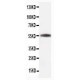 beta-Tubulin Antibody (monoclonal)