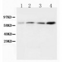 BIN1 Antibody (monoclonal)