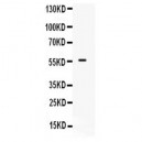 BMPR1B  Antibody