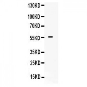 BMPR1B  Antibody