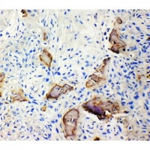 Bone Sialoprotein Antibody