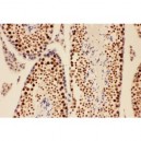 BRCA1  Antibody