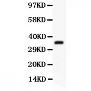 BTK  Antibody