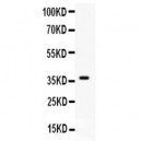 C5a  Antibody