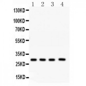 CA1  Antibody