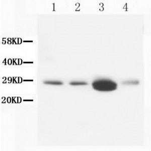 Calbindin-D Antibody (monoclonal)