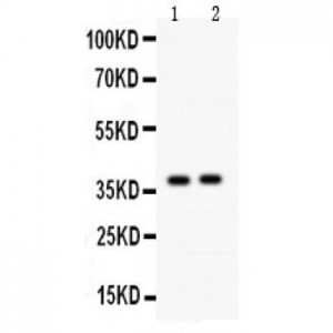 Calretinin  Antibody