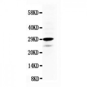 Calretinin Antibody