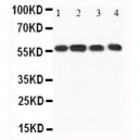 CaMKK Antibody