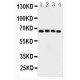 CAMKK2 Antibody