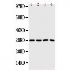 Carbonic Anhydrase III Antibody