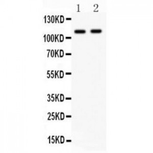 CARD4  Antibody